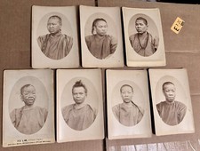 HISTORICALLY SIGNIFICANT CHINESE LEPERS SAN FRANCISCO RARE MEDICINE 19th Century picture
