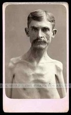 Unpublished Eisenmann Test Shot Ultra Rare CDV Photo Skeleton Man Antique picture