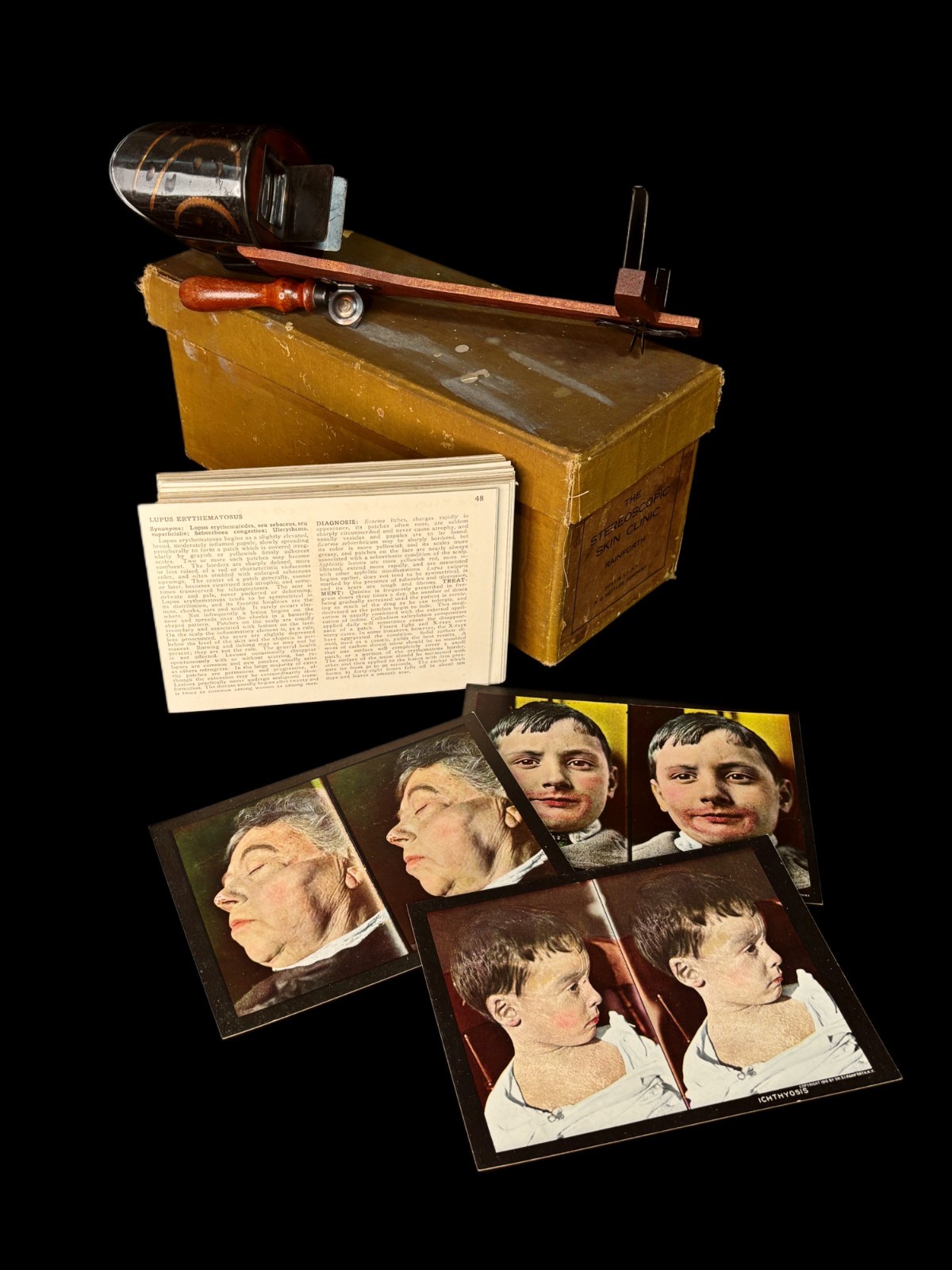 Antique 1918 Medical Stereoscopic Skin Clinic 132 Cards Complete Perfecscope Antique 1918 Medical Stereoscopic Skin Clinic 132 Cards Complete Perfecscope